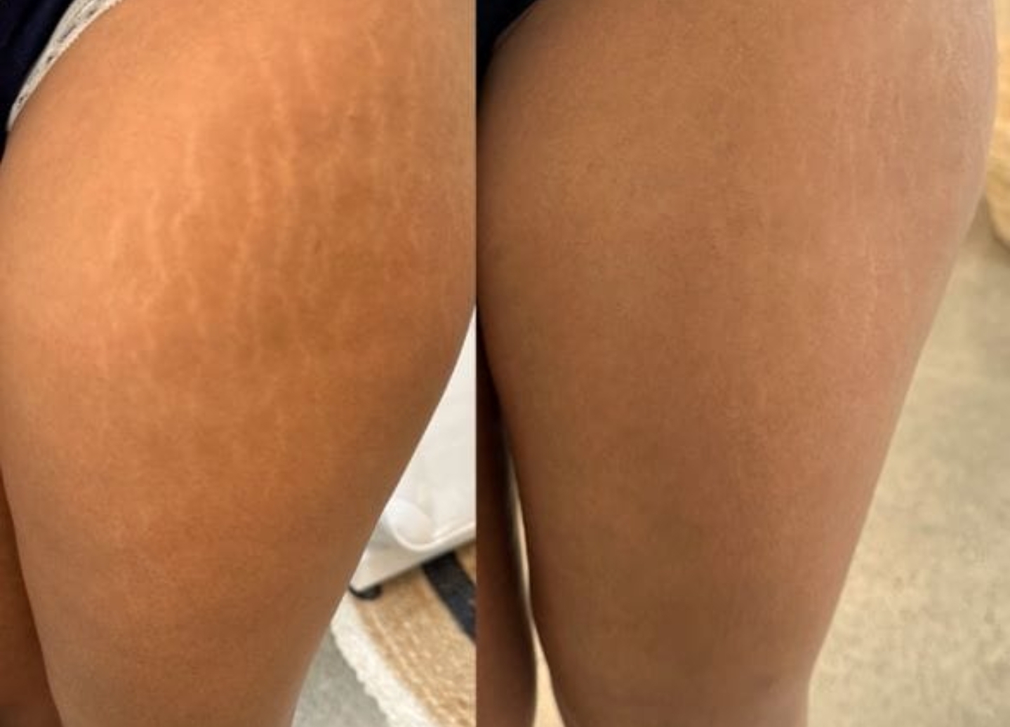 Before and after treatment 1